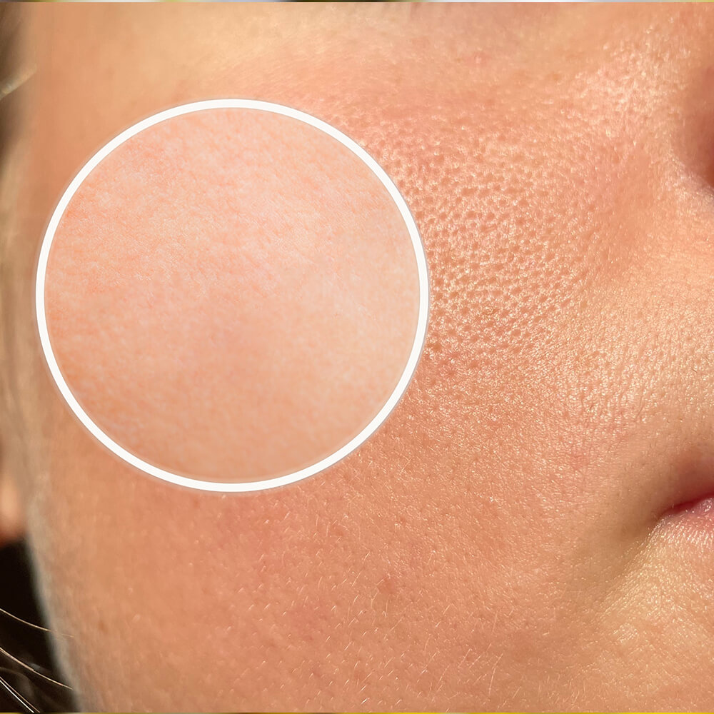 Cover serum7